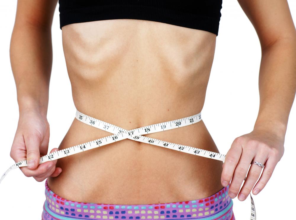 The overuse of laxatives by a person with an eating disorder may cause hemorrhoids.
