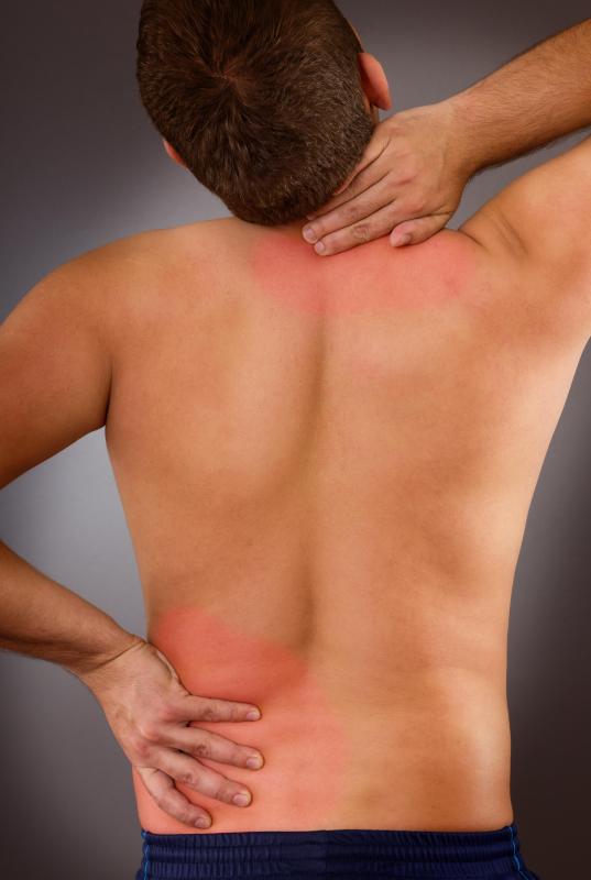 Latex pillows have contouring that can be beneficial for those with back and neck pain.